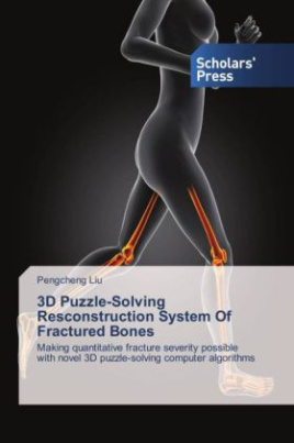3D Puzzle-Solving Resconstruction System Of Fractured Bones