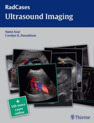 Ultrasound Imaging