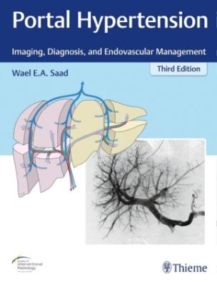 Portal Hypertension