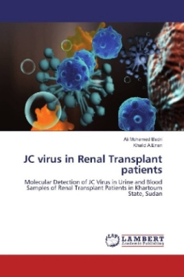 JC virus in Renal Transplant patients