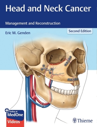 Head and Neck Cancer