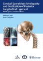 Cervical Spondylotic Myelopathy and Ossification of Posterior Longitudinal Ligament