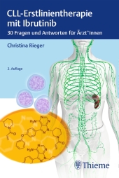 CLL-Erstlinientherapie mit Ibrutinib